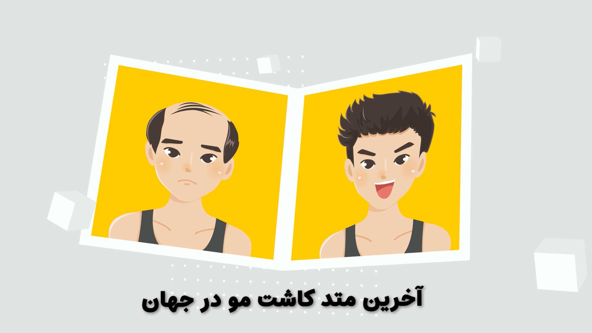 تیزر شرکت مهاجرتی